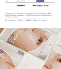 Onion Newpair Spot Patch Skin Fit