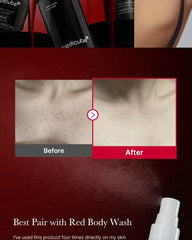 Red Acne Body Peeling Shot 2pcs Bundle Set