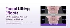 Probioderm 3D Lifting Cream