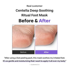 Centella Deep Soothing Ritual Foot Mask 1 pair