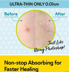 Day Use Salicylic Acid Acne Patch Plus 24 pcs