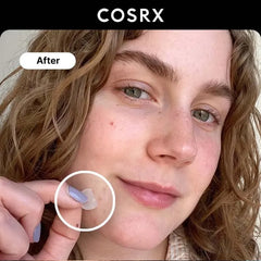 Acne Pimple Master Patch