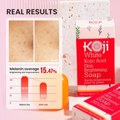 Kojic Acid Skin Brightening Soap