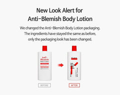 Anti Blemish Body Lotion Back & Chest