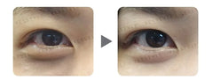 Dark Circle Removal Golden Eye Mask