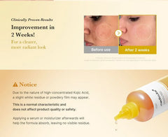 Kojic Acid Turmeric Resurfacing Toner