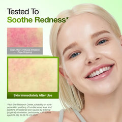 Kpop Demon Hunters Azelaic Acid 10 Hyaluron Redness Soothing Serum Set 2pcs Bundle Set