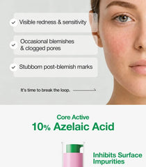 A-Control 10% Azelaic Acid Serum